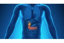 Safra Kesesinde Polip Nedir? Safra Kesesinde Polip Nedir?