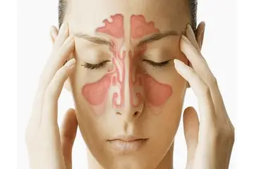 Nazal Polip Ameliyatı Riskleri ve Sonrası